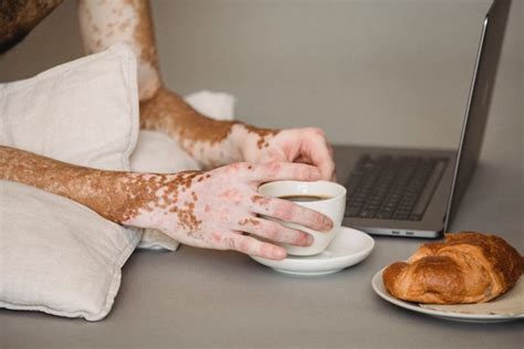 Maladie de la gaufre bleue : cest quoi, existe